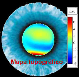 Ejemplo de mapa de aberraciones